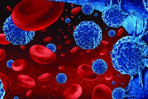 معجزہ یا سچ! نئی ٹیکنالوجی سے کینسر کے مریضوں کا علاج ممکن ۔